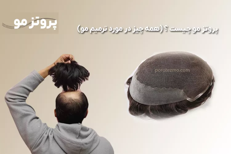پروتز مو چیست