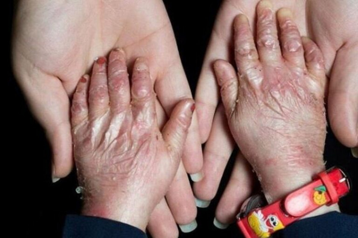 زخم بی‌توجهی بر تن پروانه‌ها