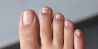 حتی غیرسیگاری‌ها در خطرند؛ ناخن‌ها راهی ساده برای شناسایی رادون