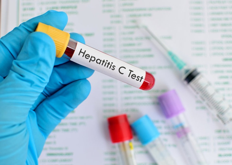 آمار نگرانکننده از شیوع هپاتیت A در ایران؛ ۳۷ درصد کودکان آلوده هستند آمار نگرانکننده از شیوع هپاتیت A در ایران؛ ۳۷ درصد کودکان آلوده هستند