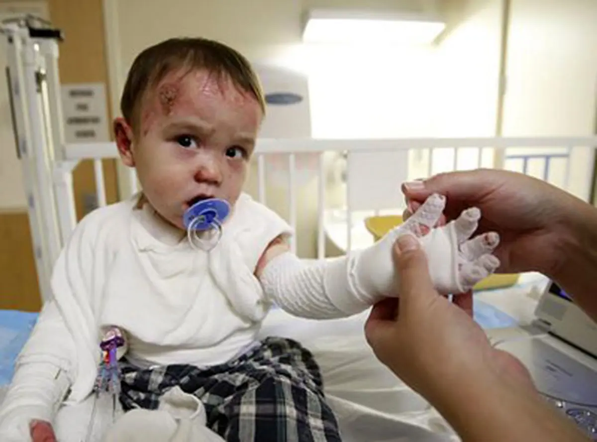 زندگی با پوست پروانه‌ای؛ خانه ای بی خدمات ویژه بیماران را ادامه می‌دهد