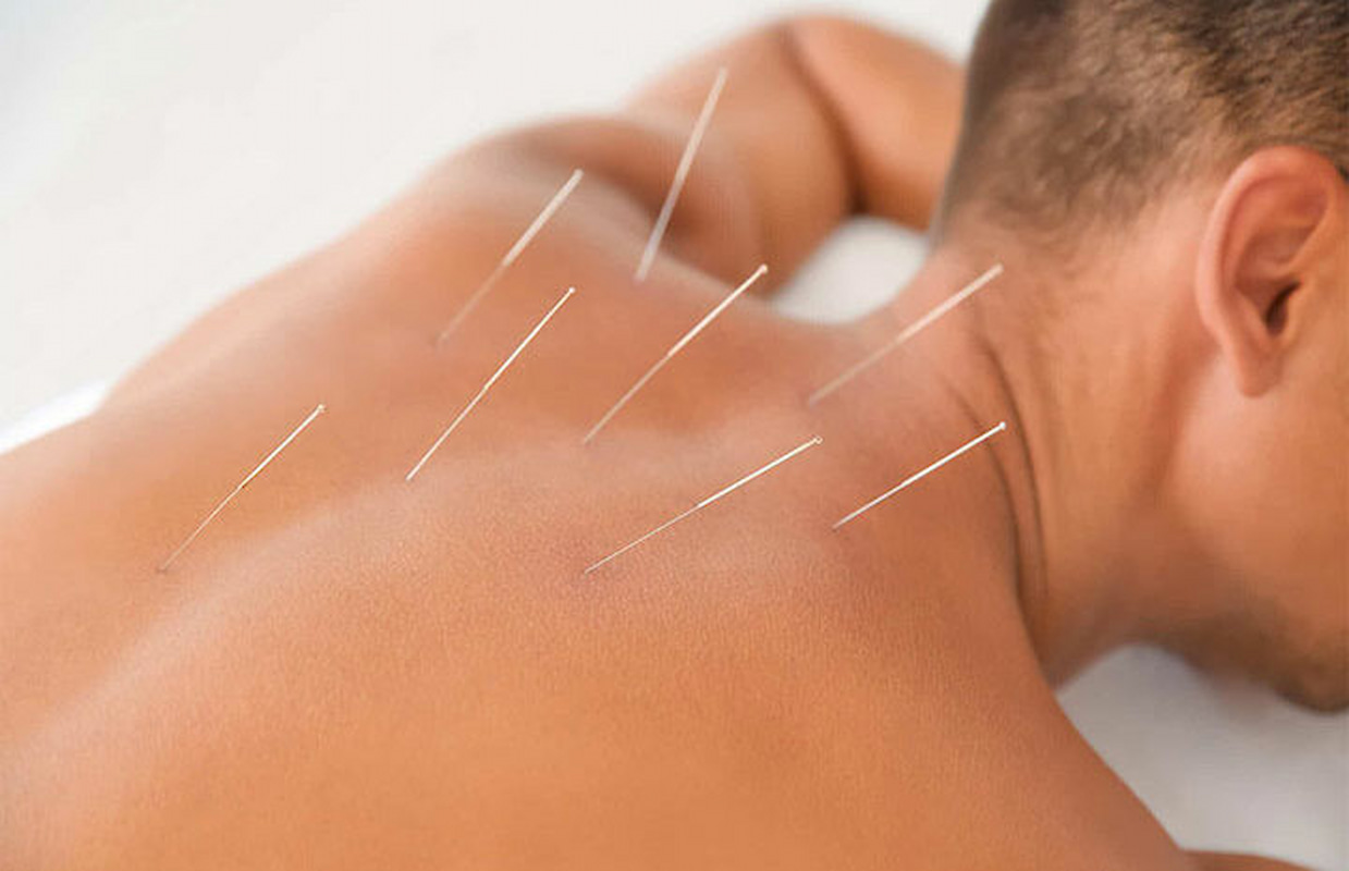 راز سوزن‌های کوچک؛ واقعیت و خیال در درمان‌های شرقی