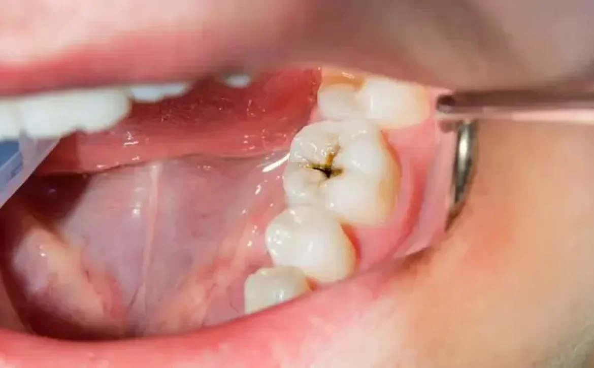 چرا سلامت دهان و دندان فقط به دندان‌ها محدود نمی‌شود؟