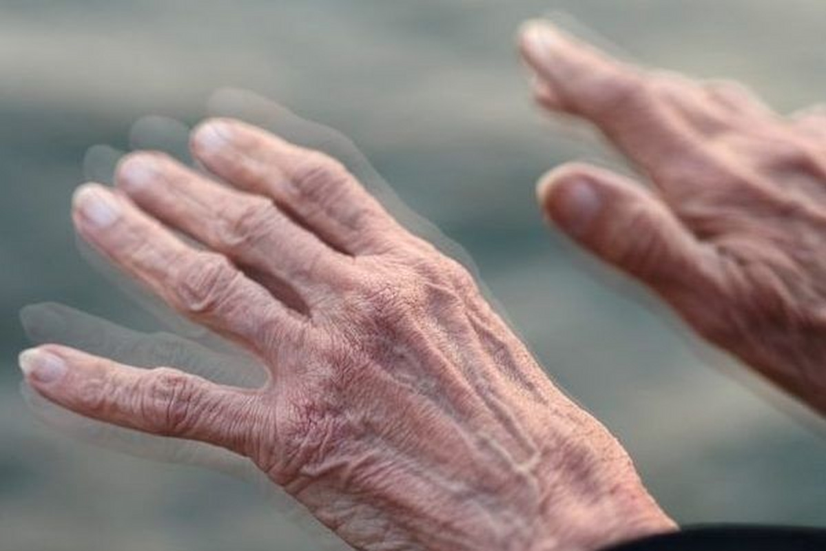 آغاز آرام یک‌بیماری پر سروصدا؛ داستان علائم اولیه پارکینسون