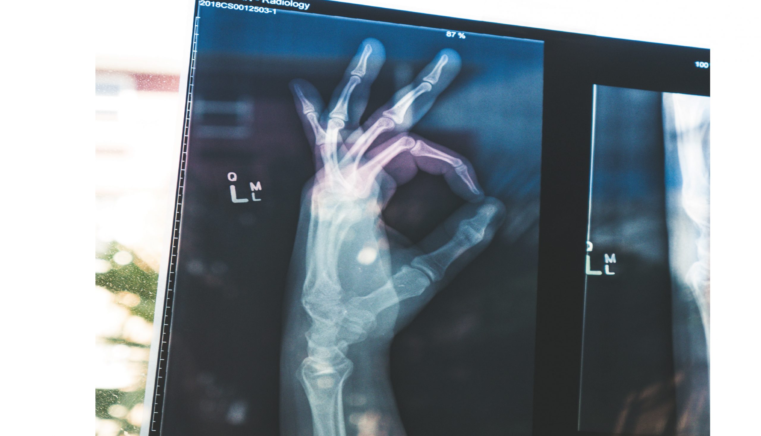 الگوریتم ،هوش مصنوعی و رادیولوژی