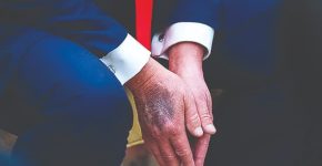 جزئیاتی از ام‌آرآی مشکوک ترامپ