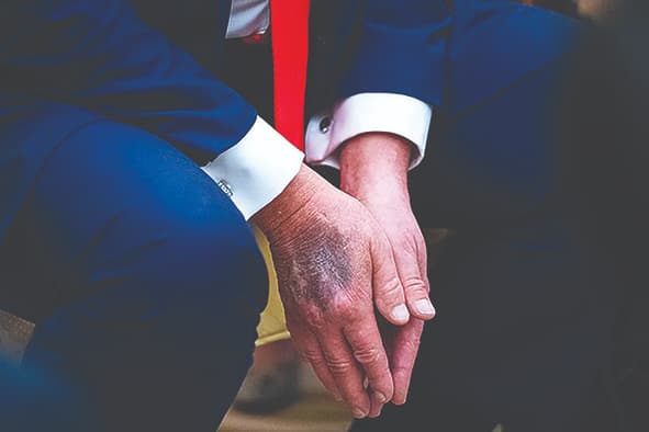 جزئیاتی از ام‌آرآی مشکوک ترامپ