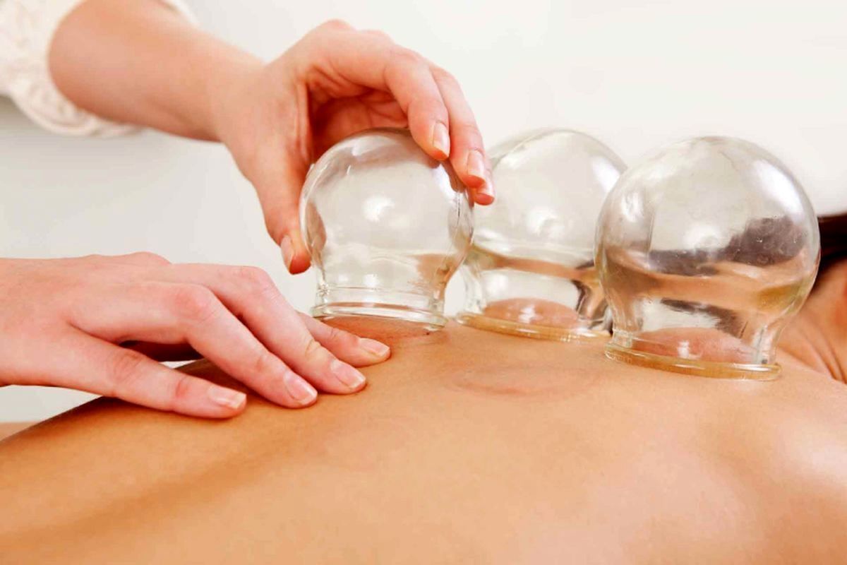 هشدار وزارت بهداشت درباره انجام خودسرانه حجامت/ ضرورت تجویز پزشکان و متخصص طب ایرانی